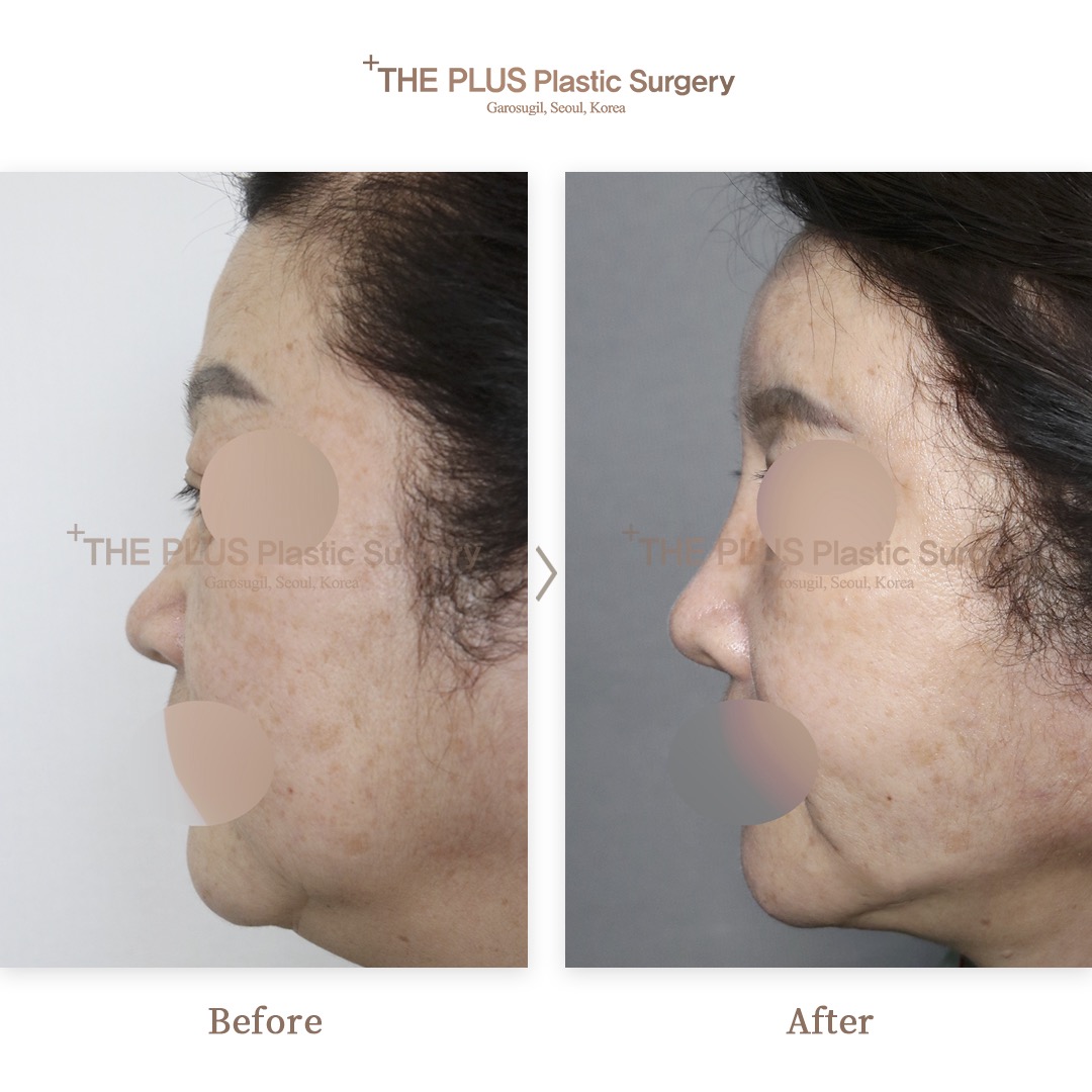THE PLUS CLINIC KOREA -