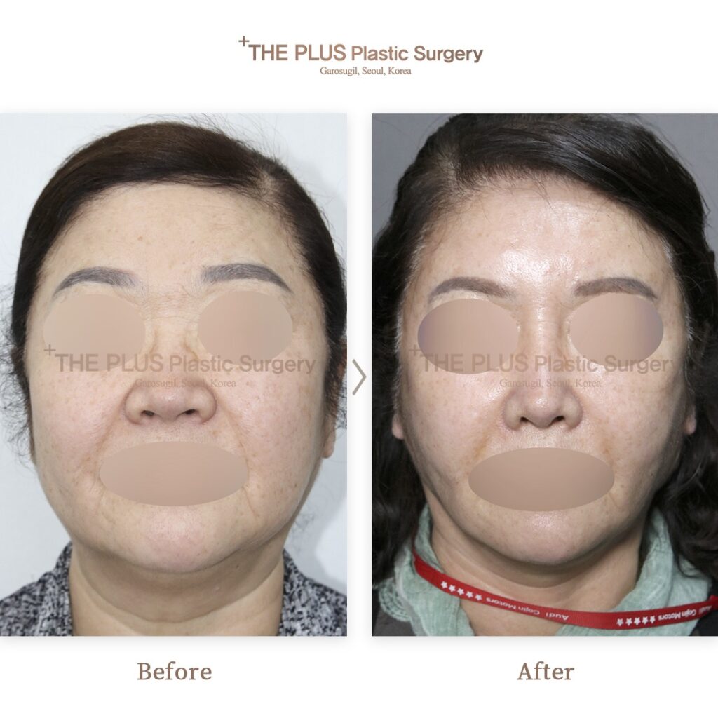 THE PLUS CLINIC KOREA -