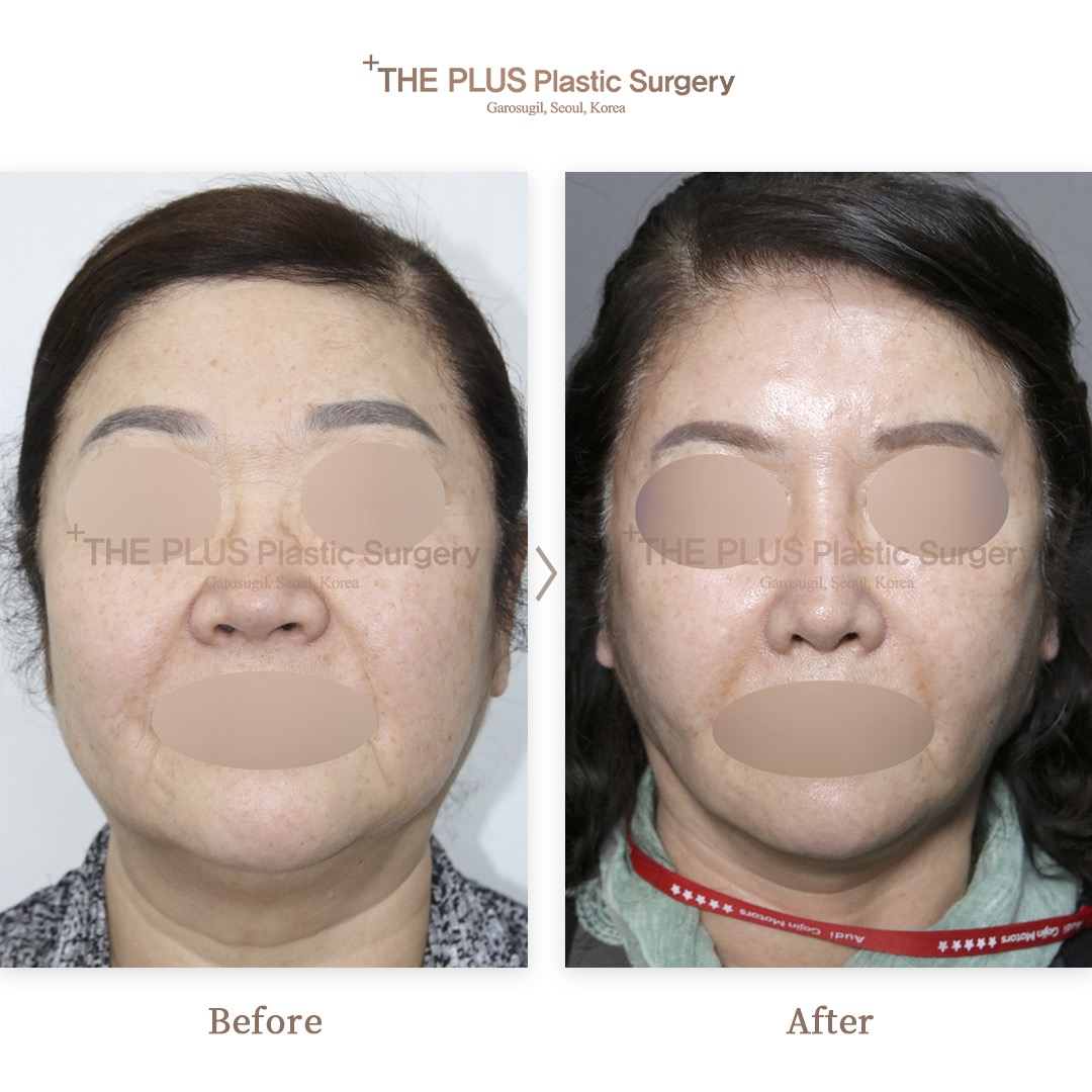 THE PLUS CLINIC KOREA -