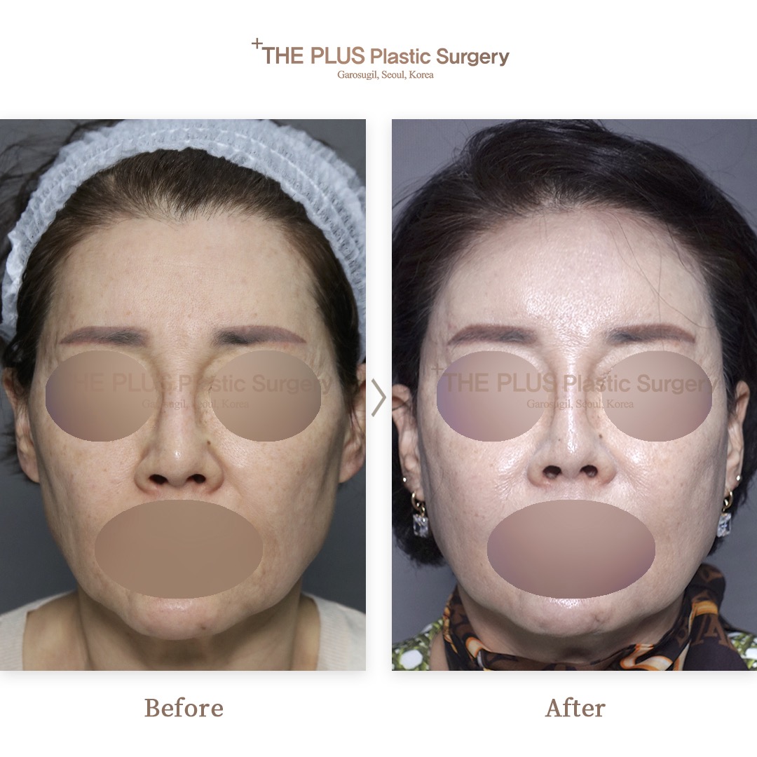 THE PLUS CLINIC KOREA -