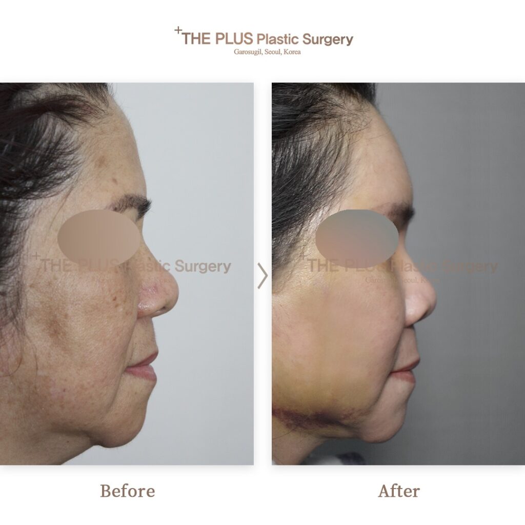 THE PLUS CLINIC KOREA -