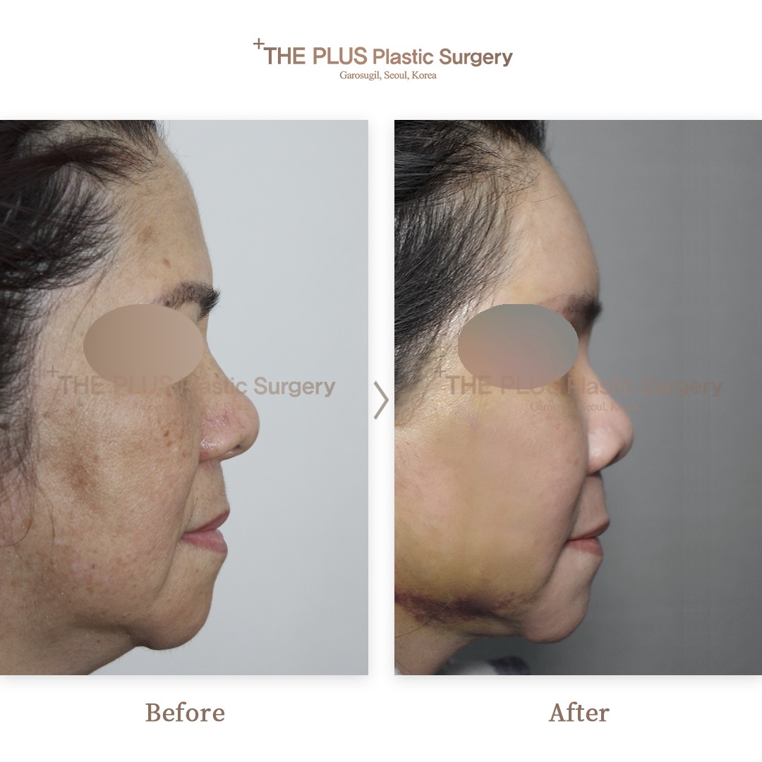 THE PLUS CLINIC KOREA -