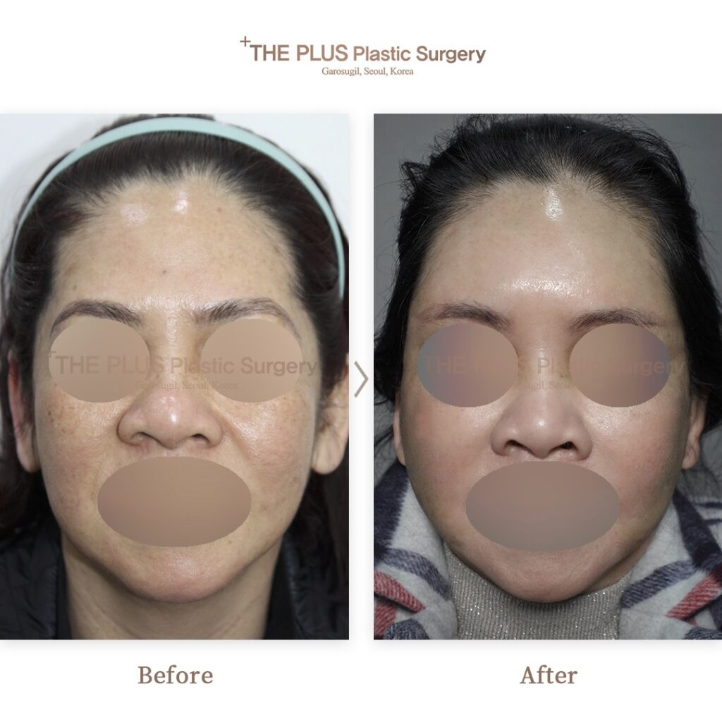 THE PLUS CLINIC KOREA -