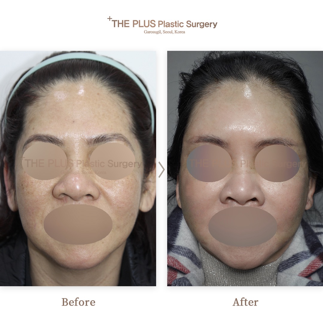 THE PLUS CLINIC KOREA -