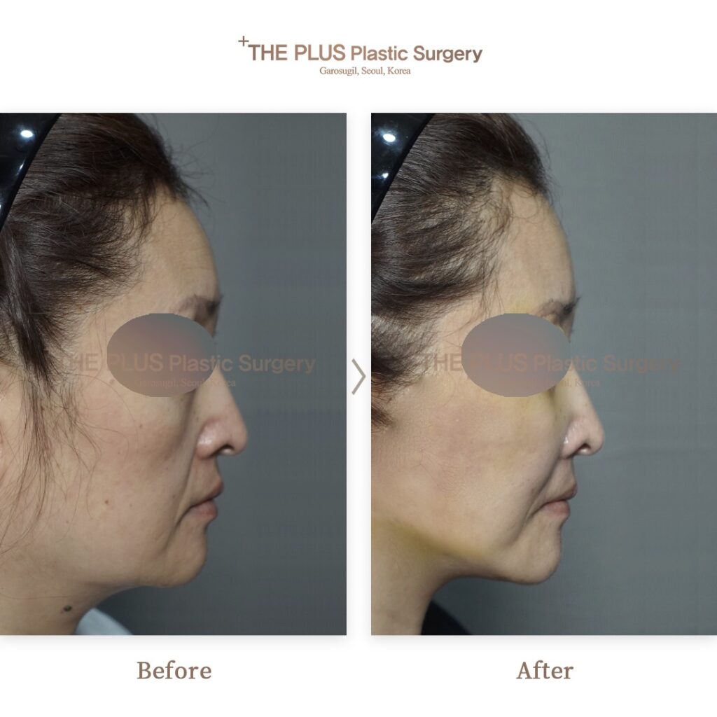 THE PLUS CLINIC KOREA -