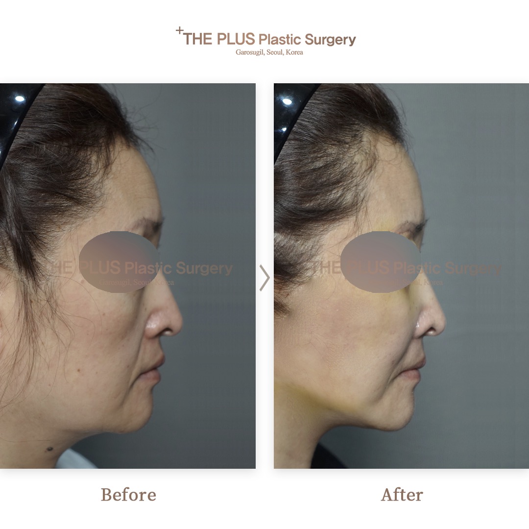 THE PLUS CLINIC KOREA -