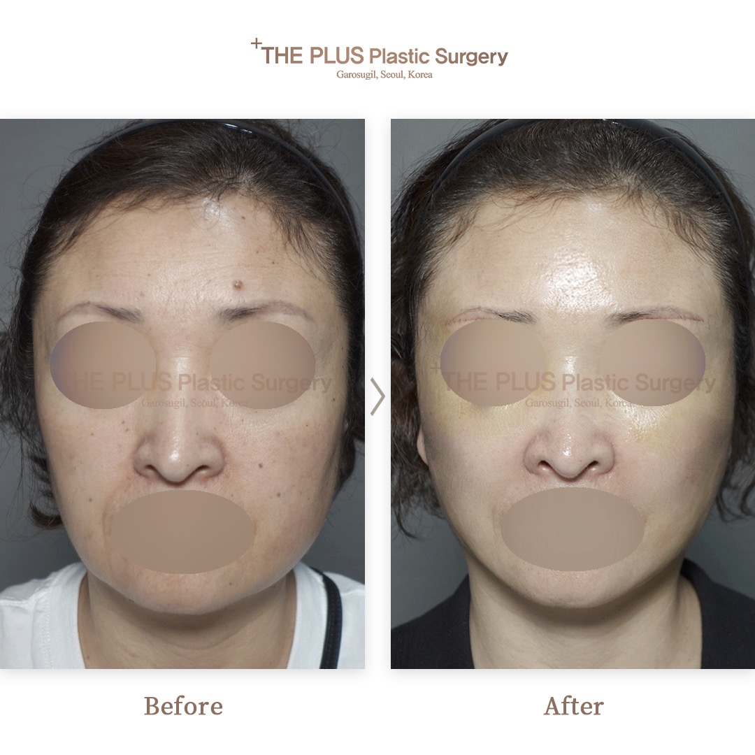 THE PLUS CLINIC KOREA -