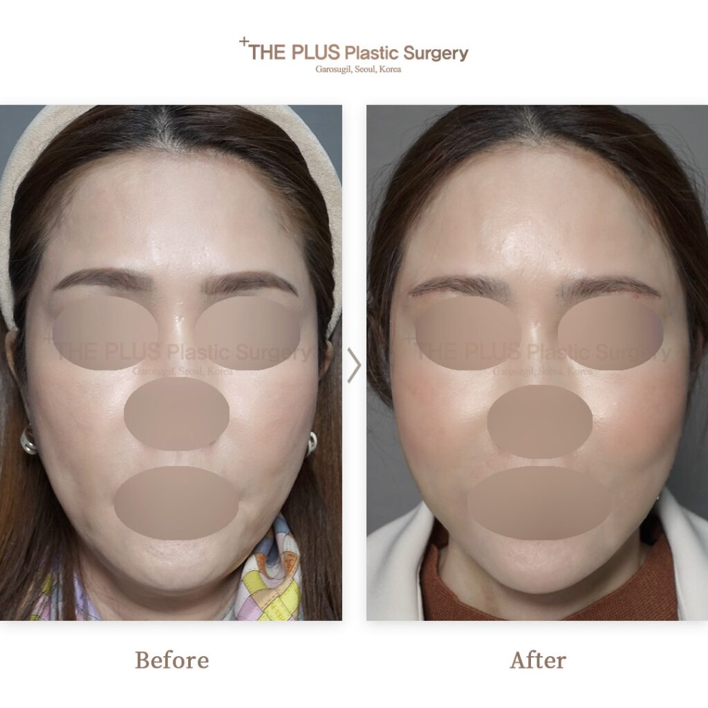 THE PLUS CLINIC KOREA -