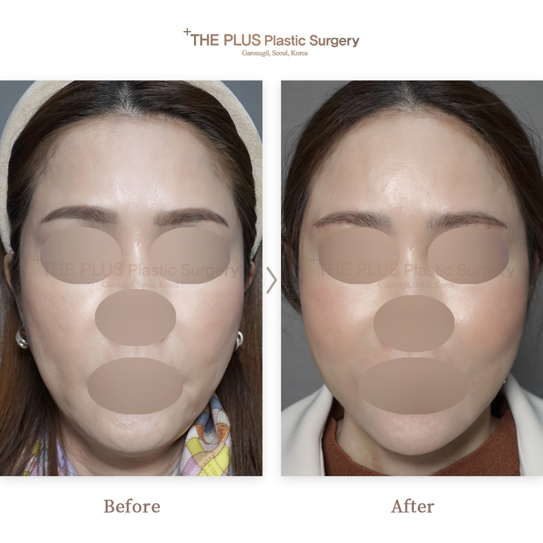 THE PLUS CLINIC KOREA -