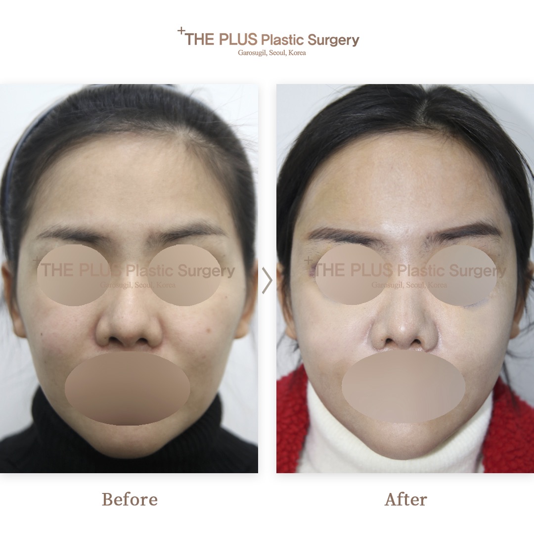 THE PLUS CLINIC KOREA -