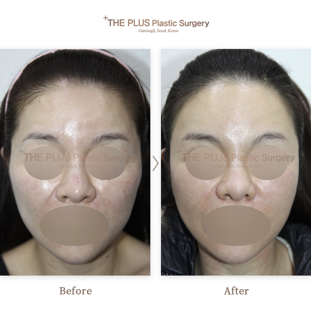 THE PLUS CLINIC KOREA -