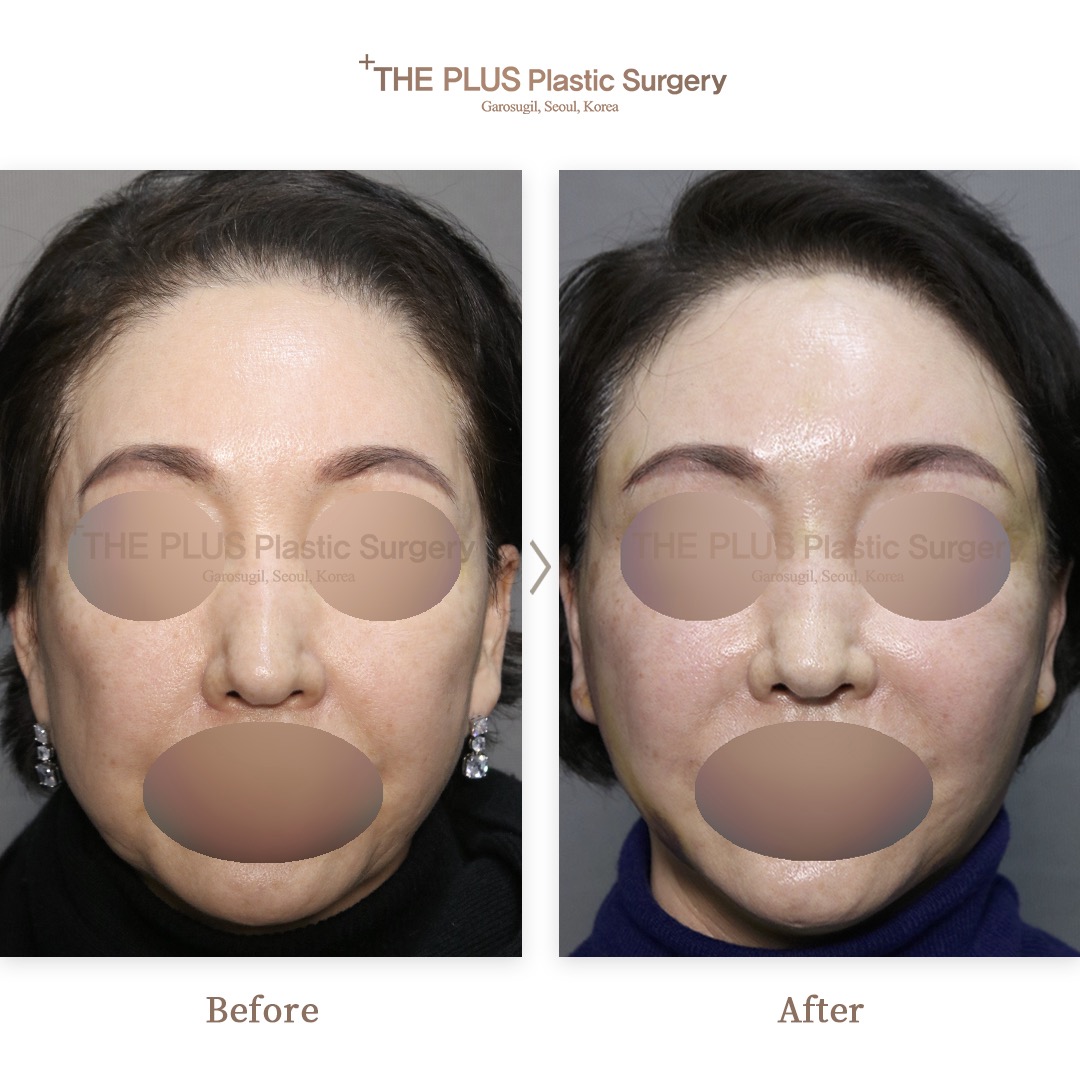 THE PLUS CLINIC KOREA -