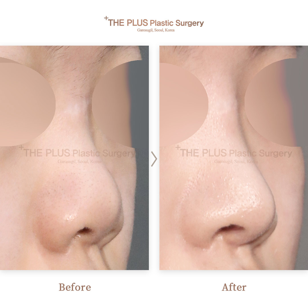 THE PLUS CLINIC KOREA -