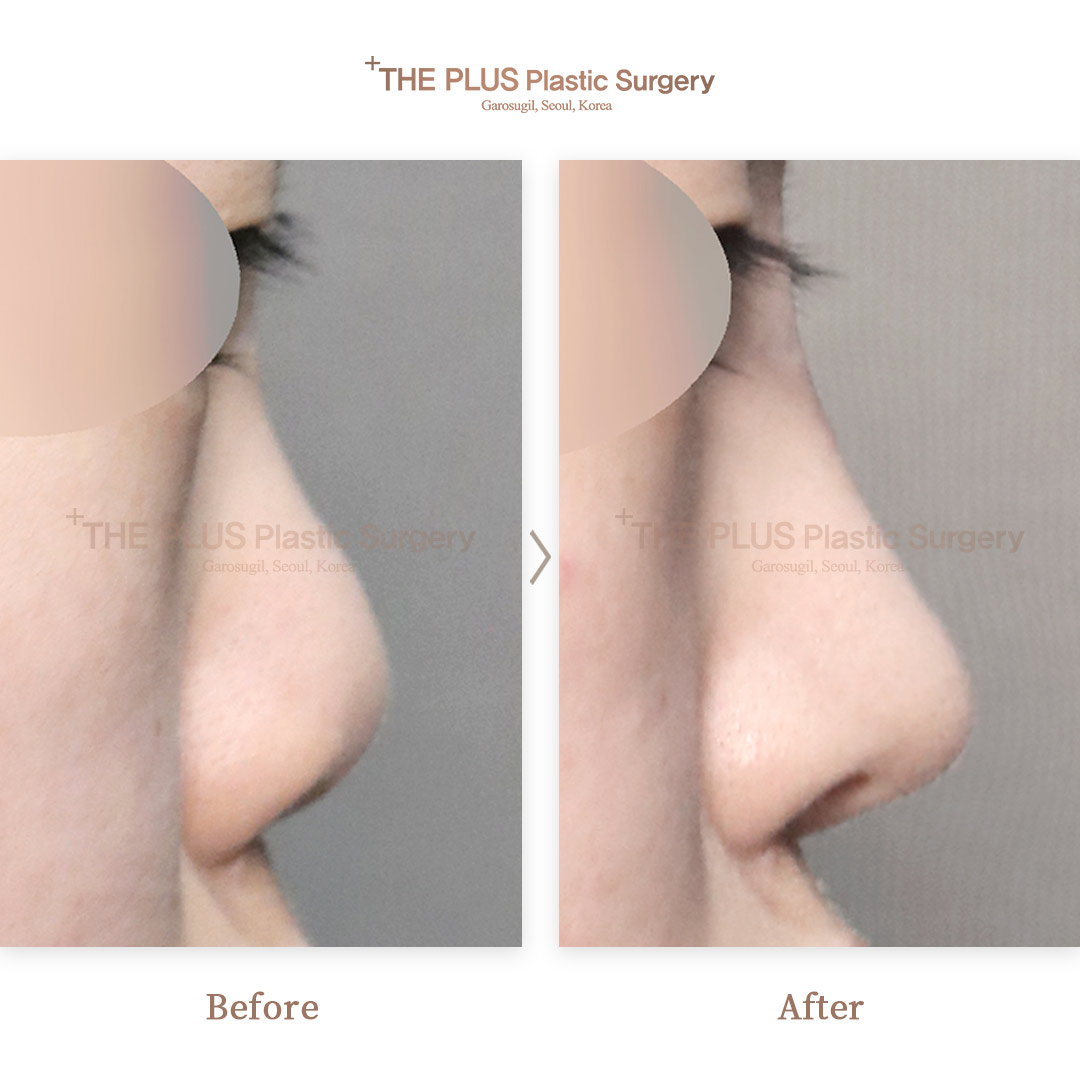 THE PLUS CLINIC KOREA -