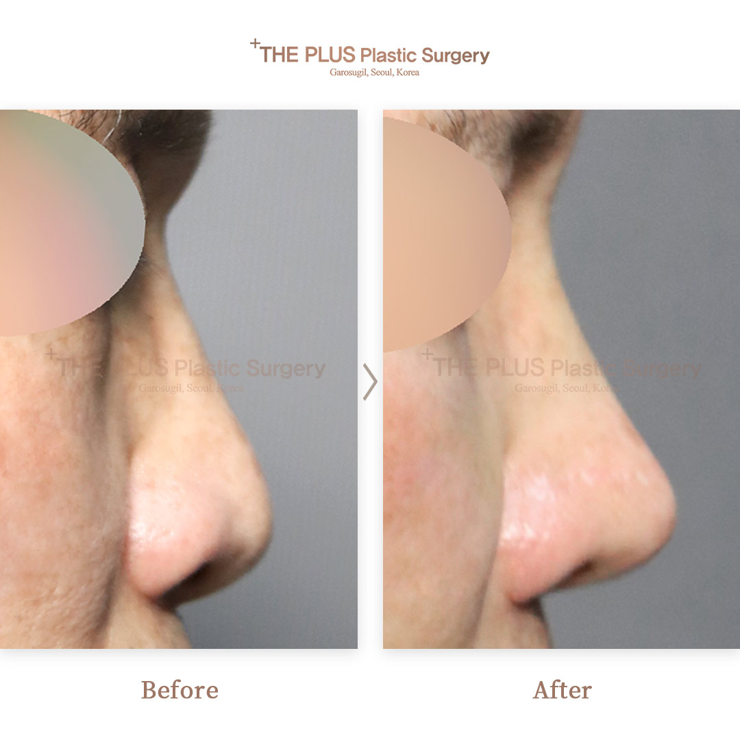 THE PLUS CLINIC KOREA -