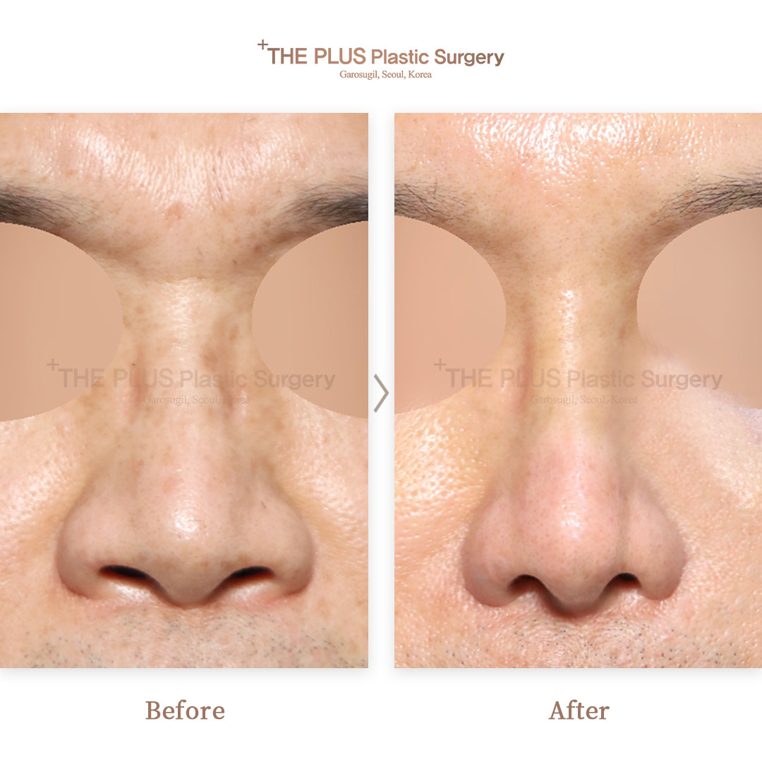THE PLUS CLINIC KOREA -