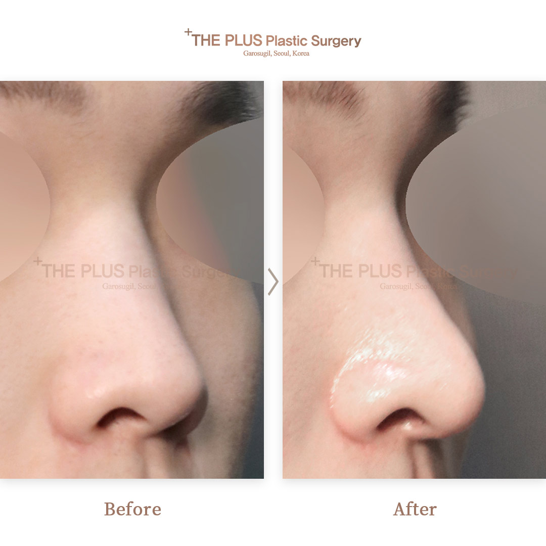 THE PLUS CLINIC KOREA -