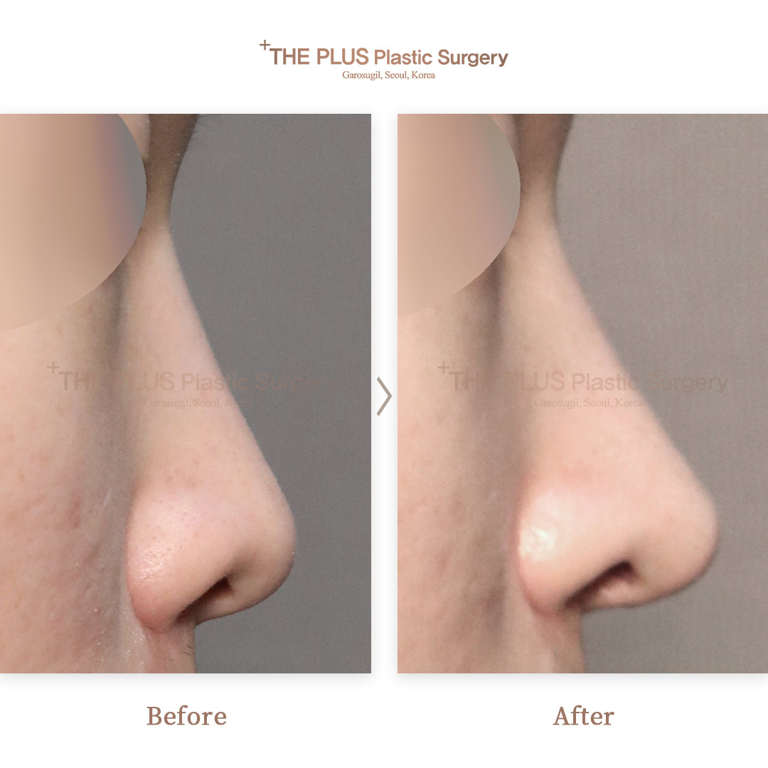THE PLUS CLINIC KOREA -
