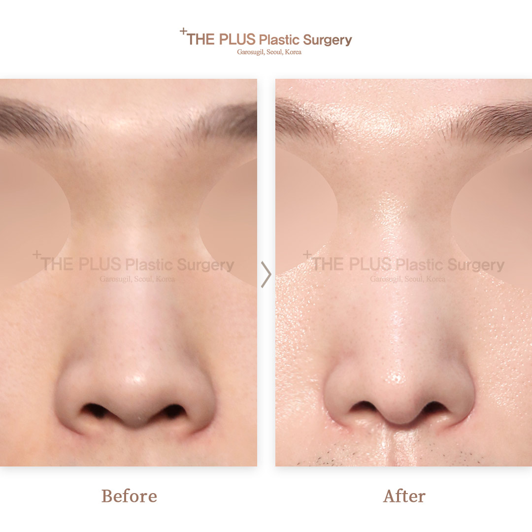 THE PLUS CLINIC KOREA -