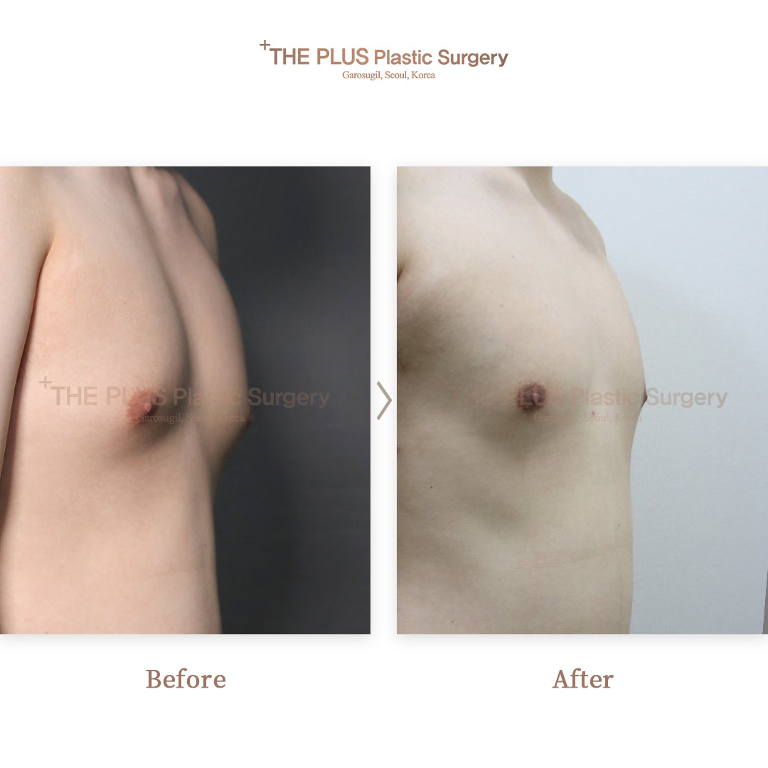 THE PLUS CLINIC KOREA -