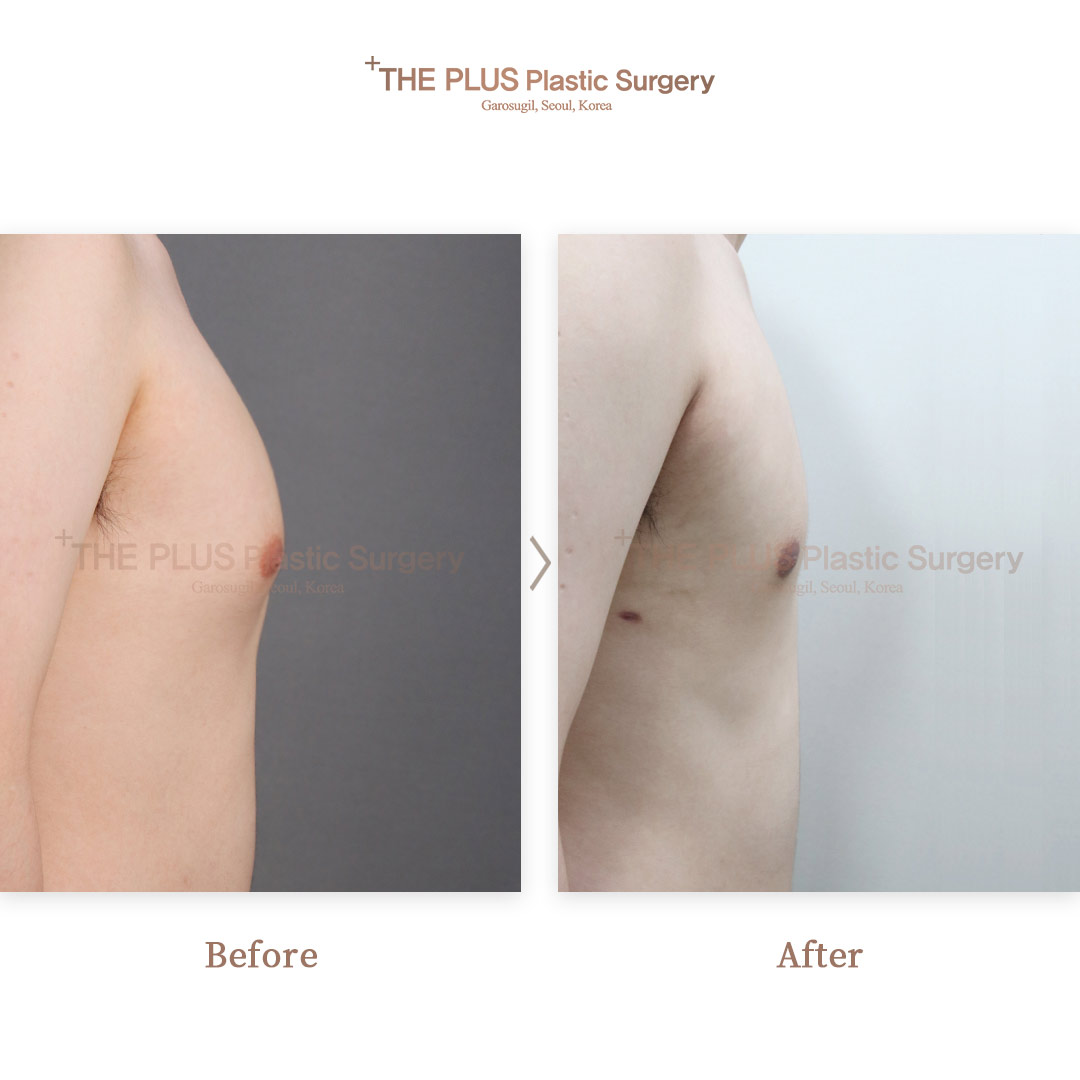 THE PLUS CLINIC KOREA -