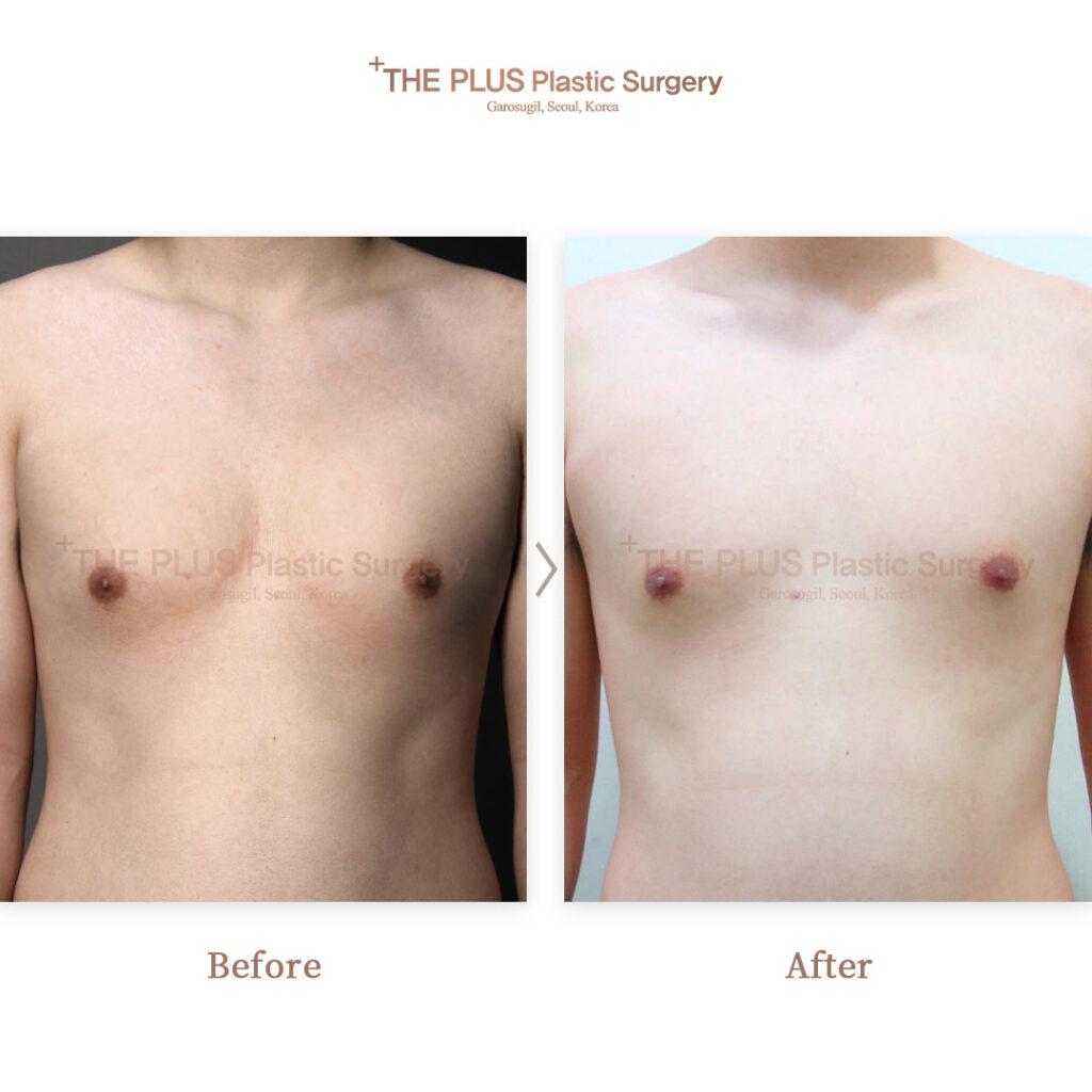 THE PLUS CLINIC KOREA -