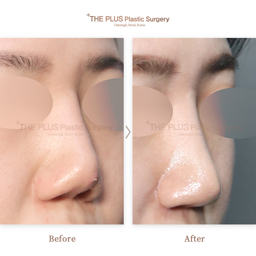 THE PLUS CLINIC KOREA -