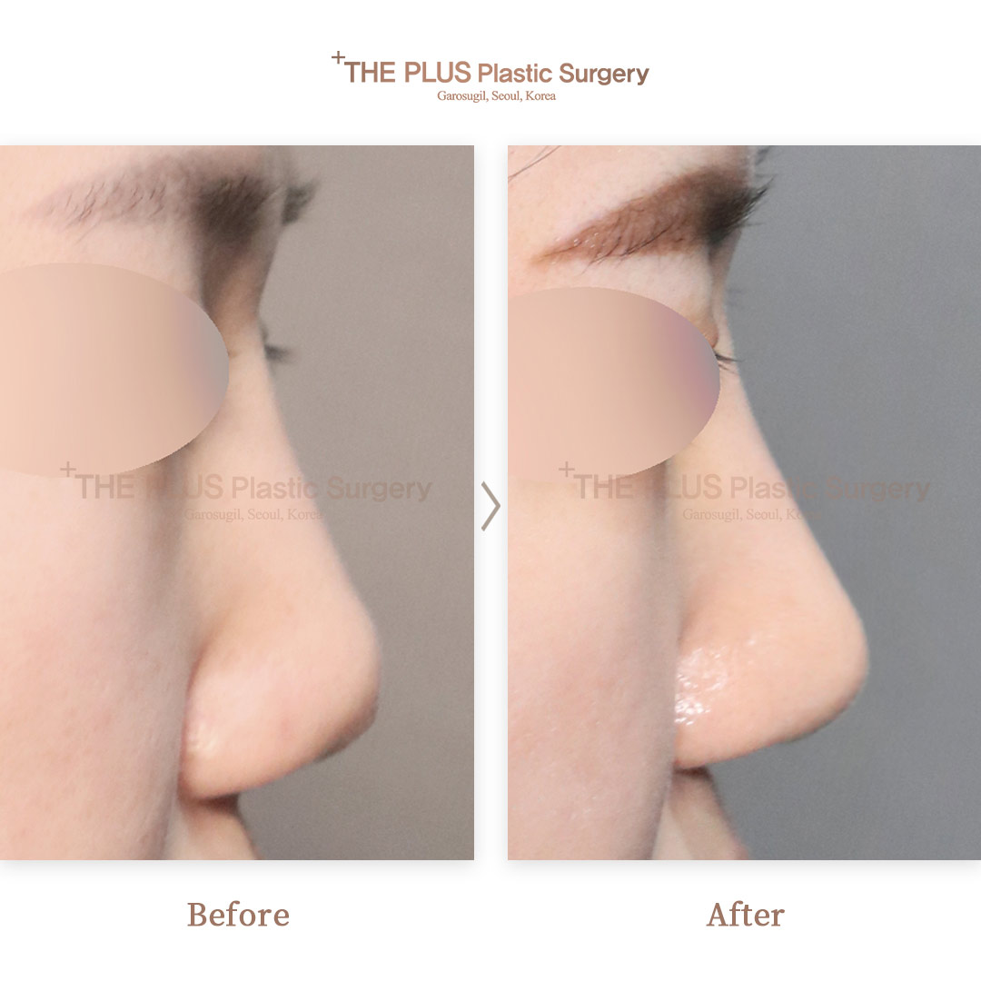 THE PLUS CLINIC KOREA -