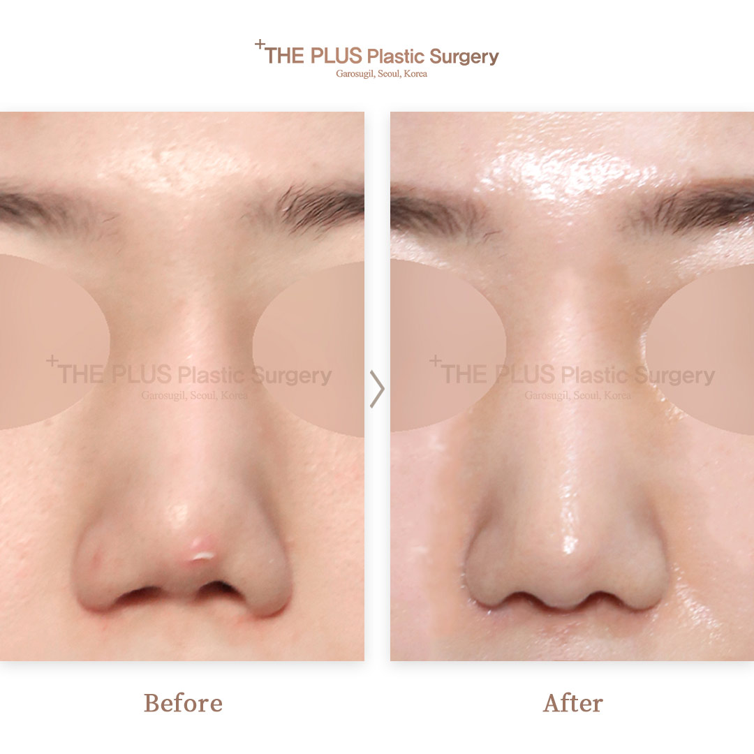 THE PLUS CLINIC KOREA -