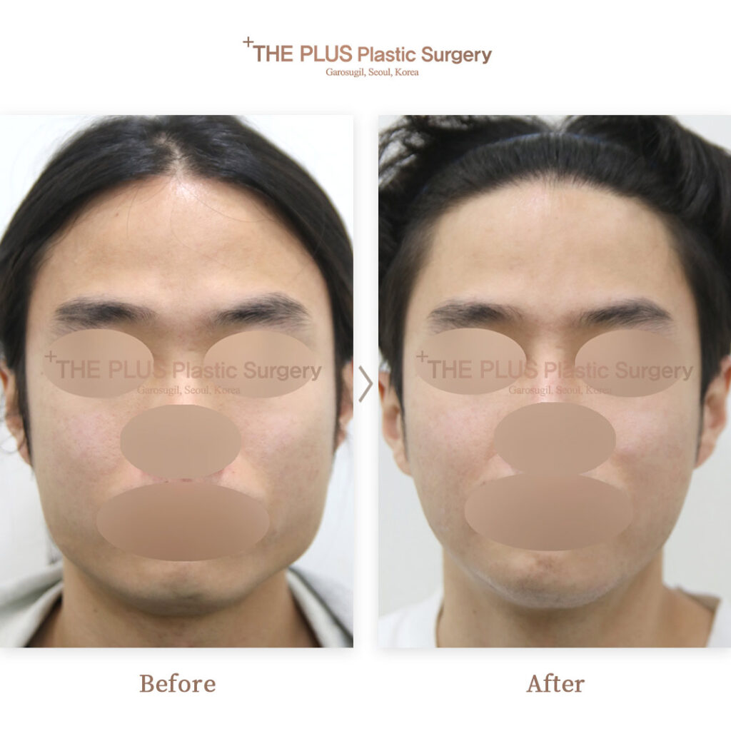 THE PLUS CLINIC KOREA -