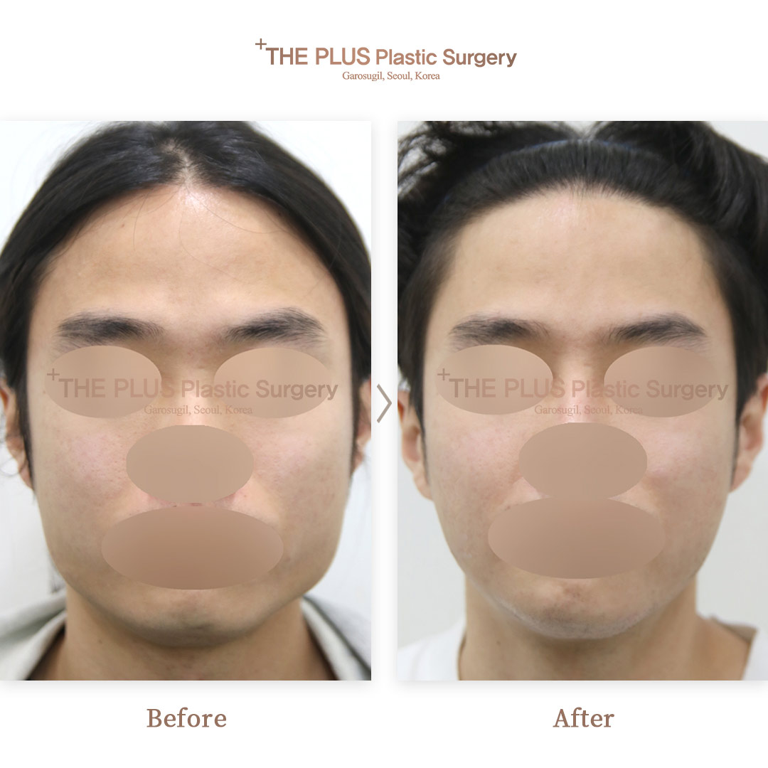 THE PLUS CLINIC KOREA -