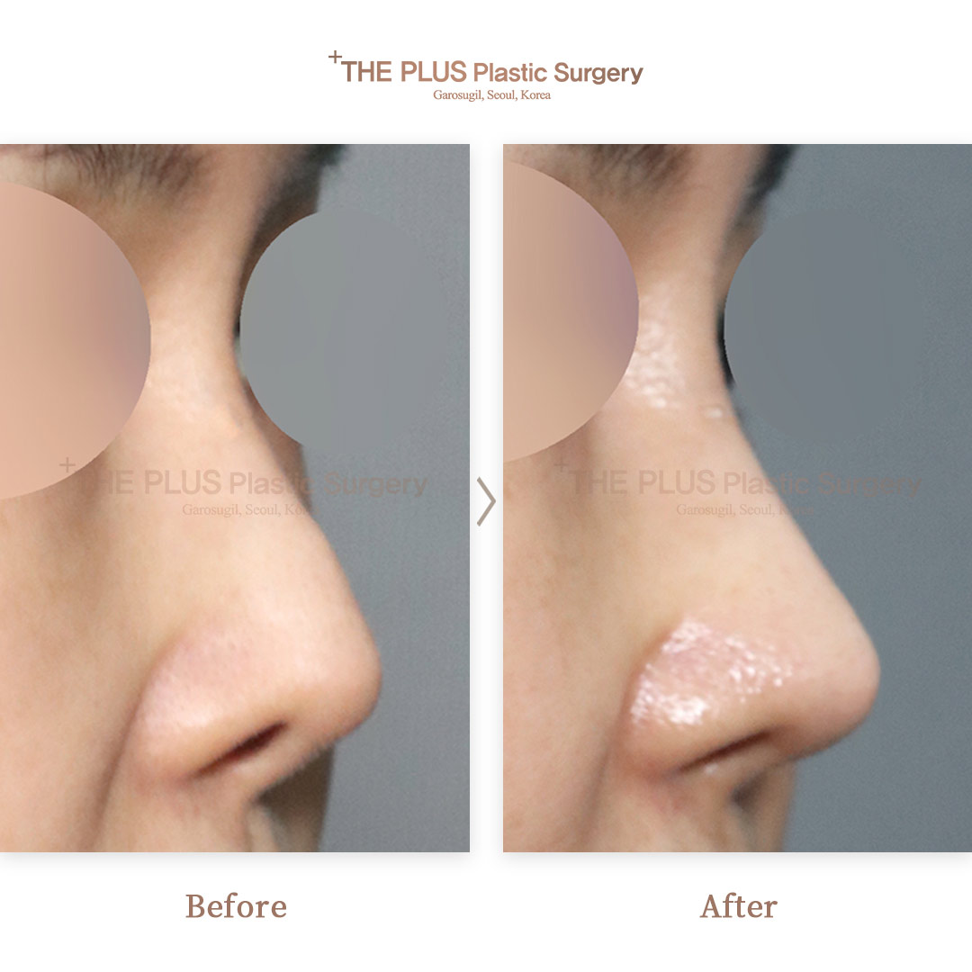 THE PLUS CLINIC KOREA -