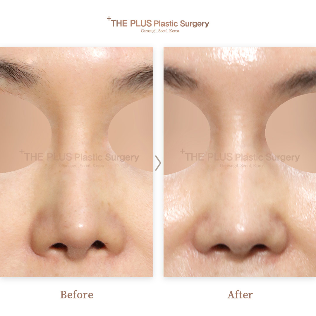 THE PLUS CLINIC KOREA -