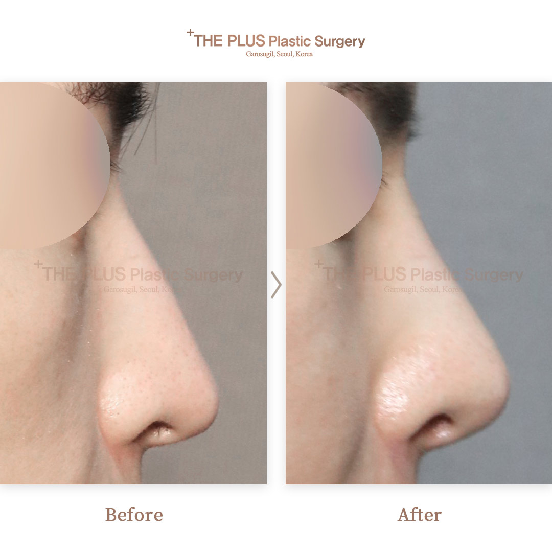 THE PLUS CLINIC KOREA -