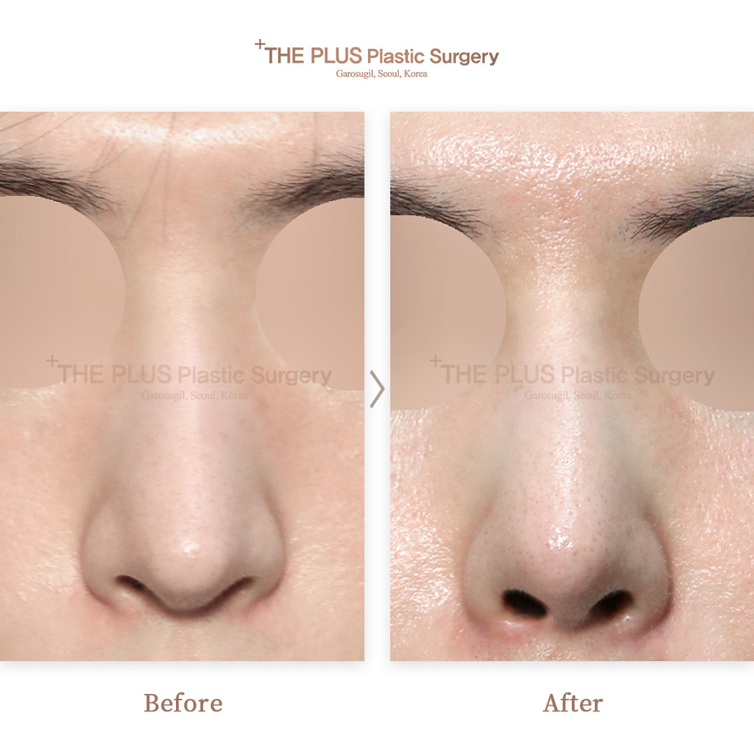 THE PLUS CLINIC KOREA -