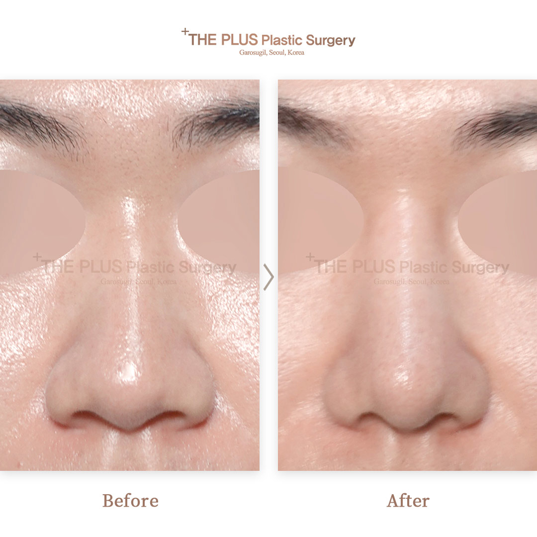 THE PLUS CLINIC KOREA -