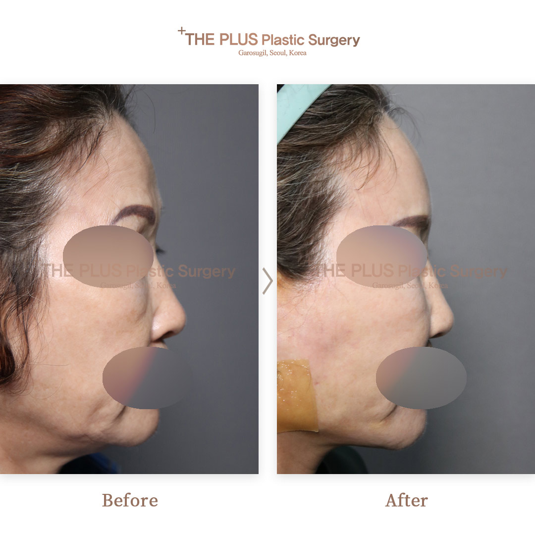 THE PLUS CLINIC KOREA -