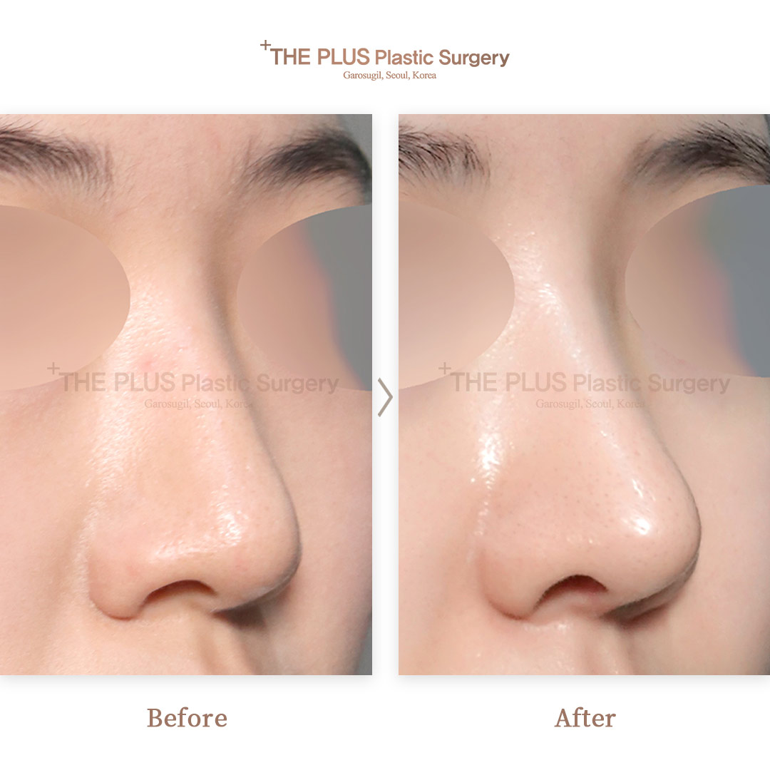 THE PLUS CLINIC KOREA -