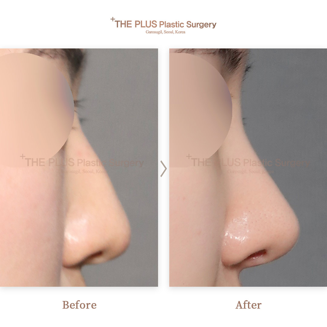 THE PLUS CLINIC KOREA -