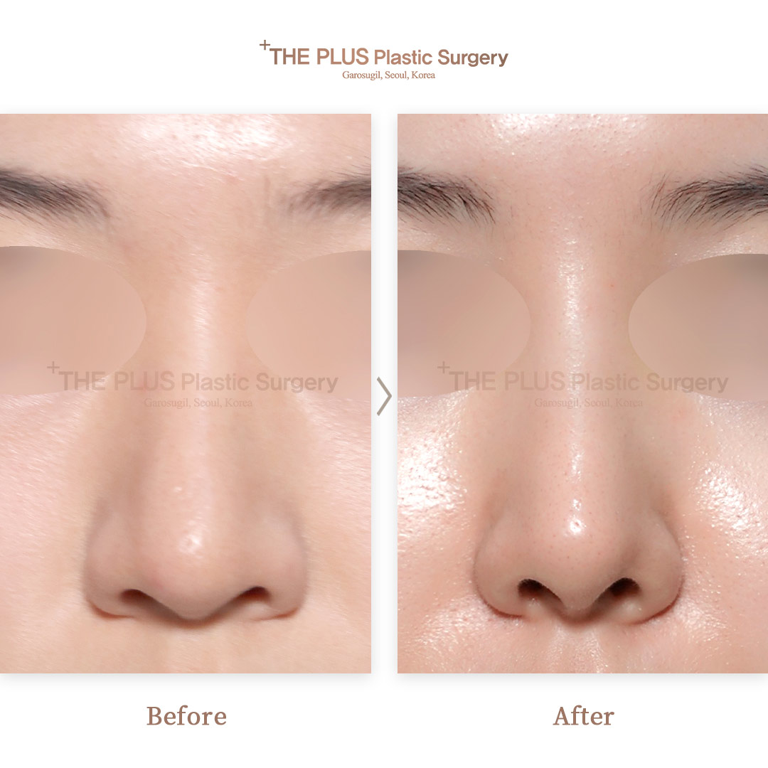 THE PLUS CLINIC KOREA -