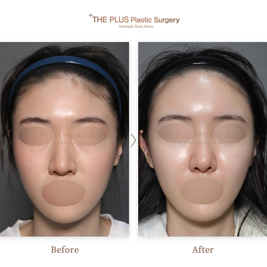 THE PLUS CLINIC KOREA -