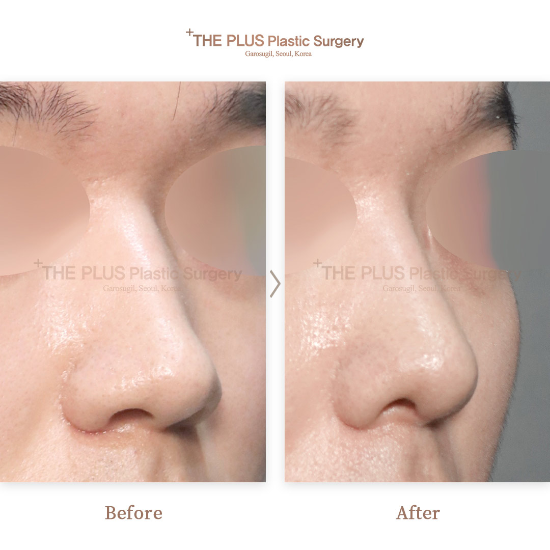 THE PLUS CLINIC KOREA -