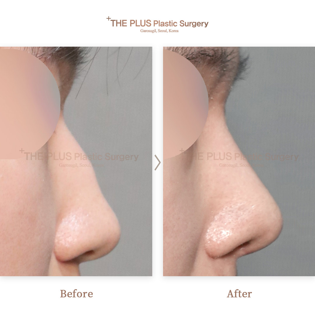 THE PLUS CLINIC KOREA -