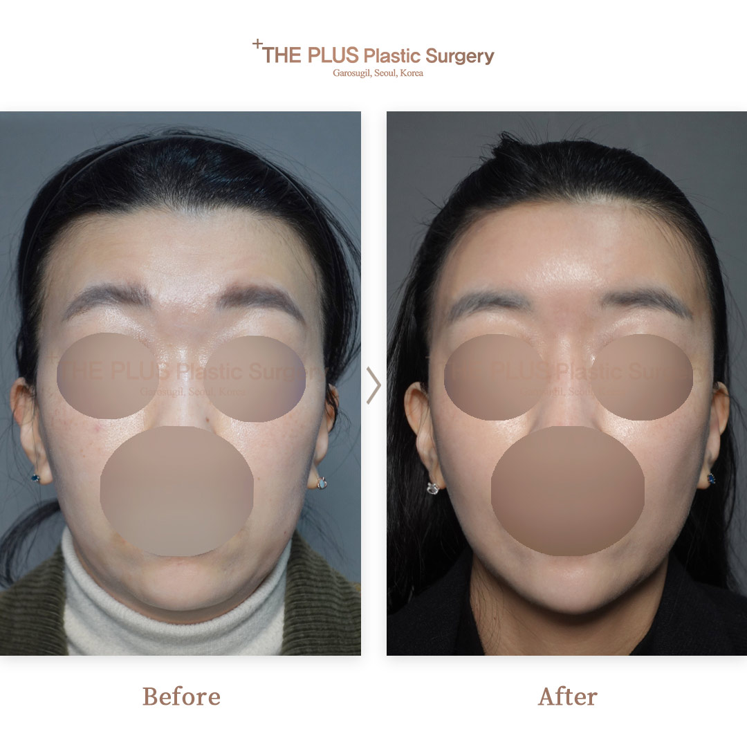 THE PLUS CLINIC KOREA -