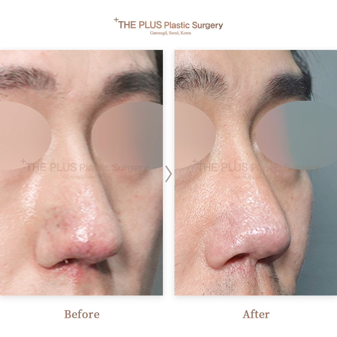 THE PLUS CLINIC KOREA -