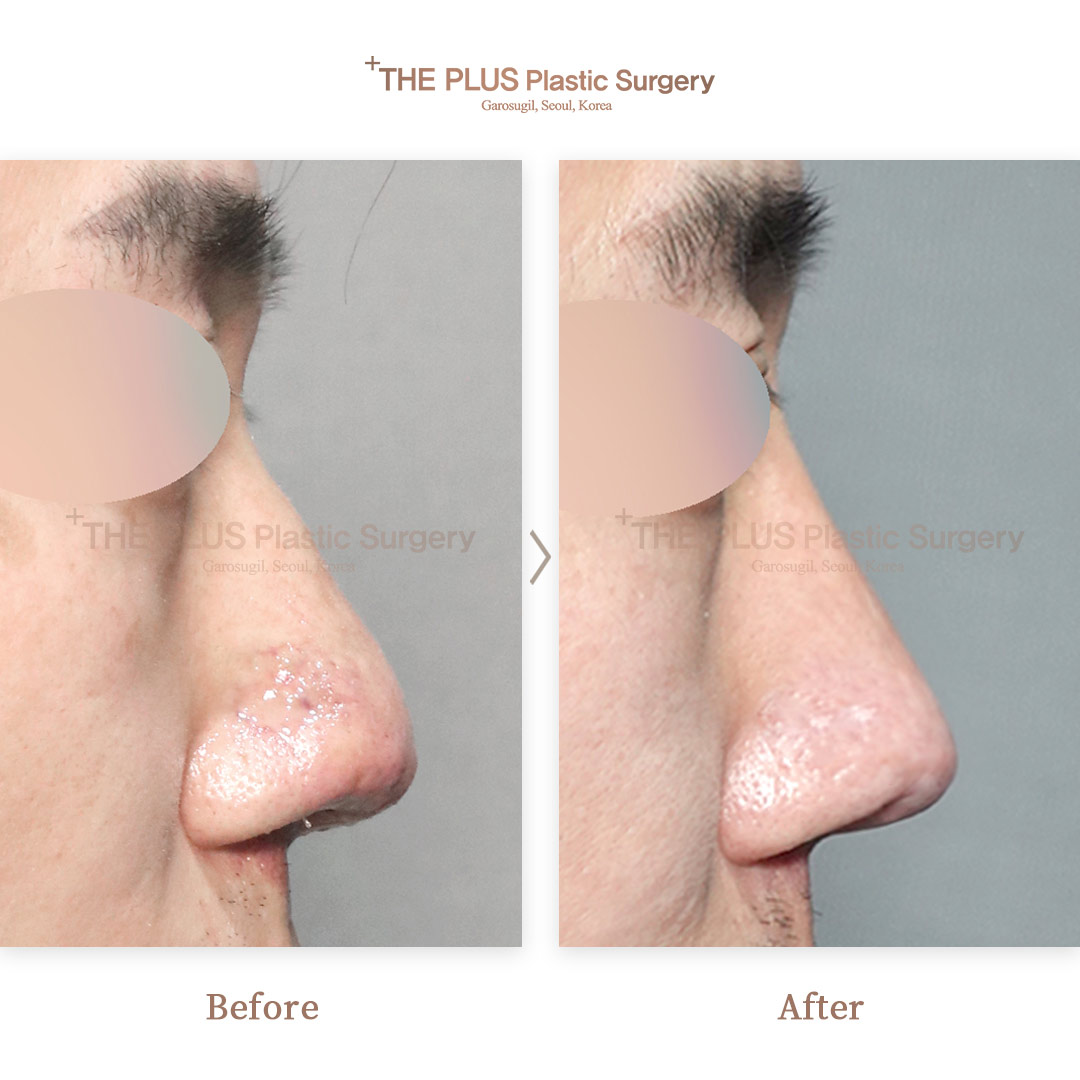 THE PLUS CLINIC KOREA -