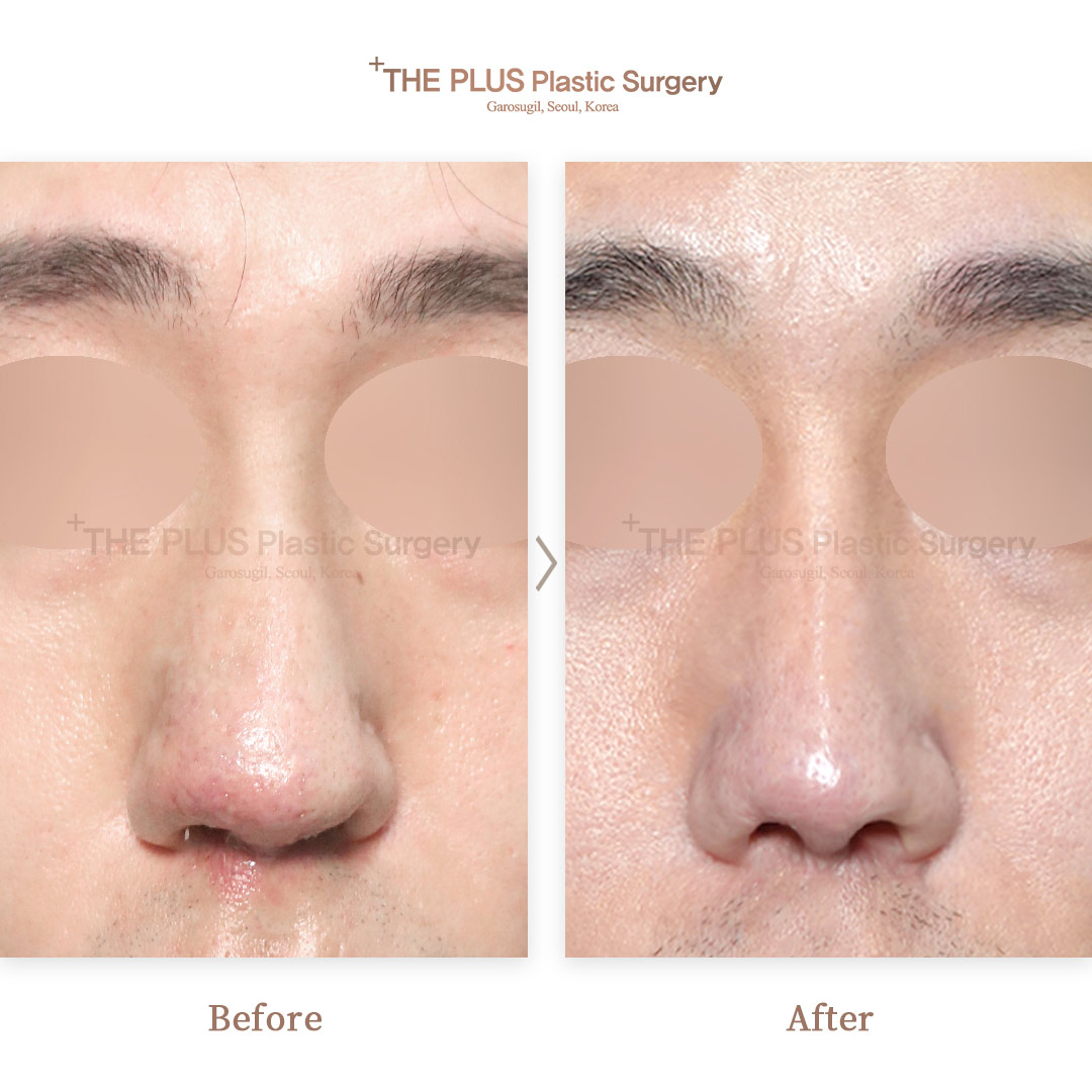 THE PLUS CLINIC KOREA -