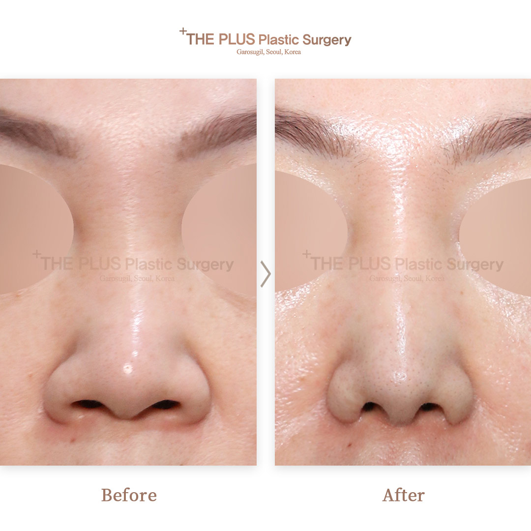 THE PLUS CLINIC KOREA -