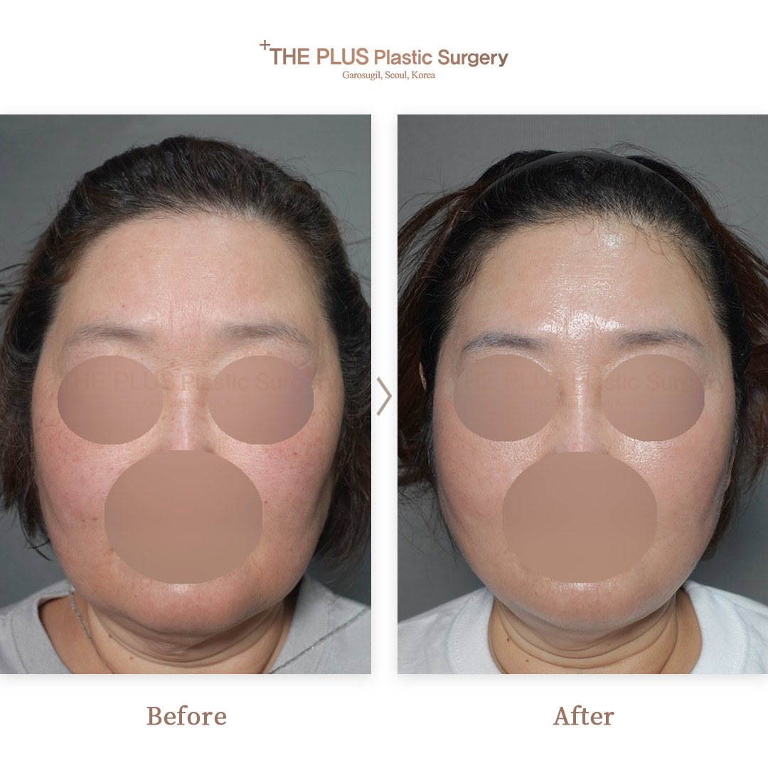 THE PLUS CLINIC KOREA -