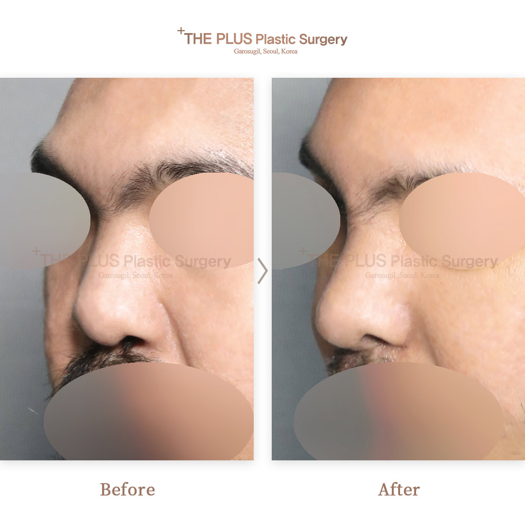 THE PLUS CLINIC KOREA -